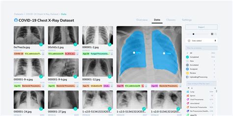 xray github.